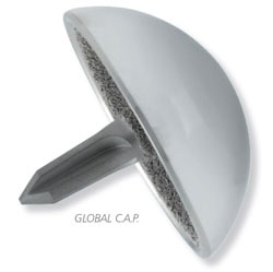 Global CAP